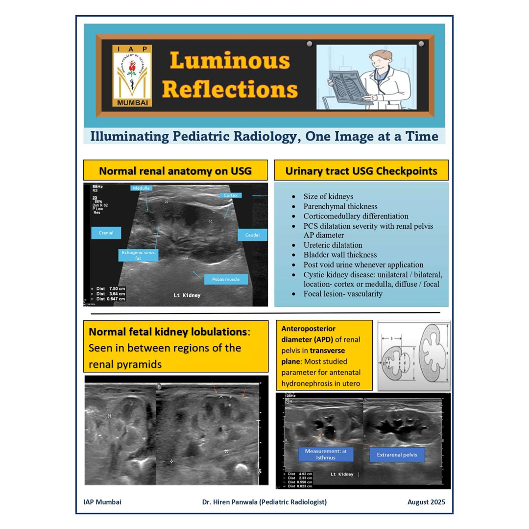 Luminous reflections