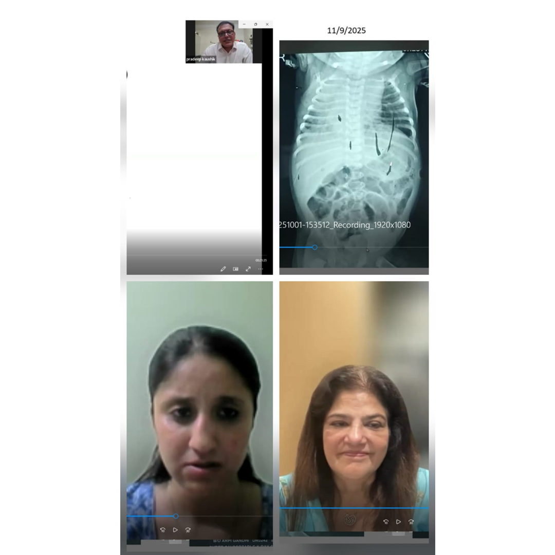 Pulmo-Radio Cross talk